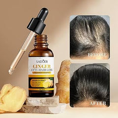 Sadoer Ginger Anti-hair Loss Treatment Essence 30ml – Restores Hair, Promotes Growth