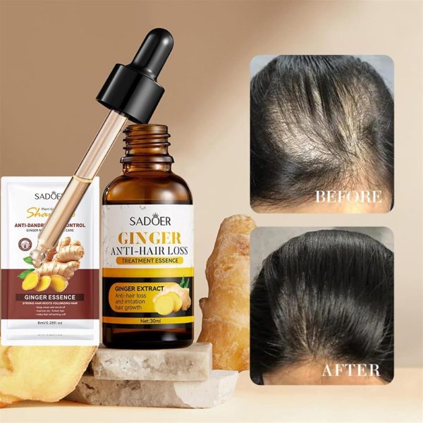 Sadoer Ginger Anti-hair Loss Treatment Essence 30ml – Restores Hair, Promotes Growth